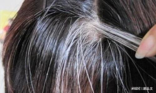 头上白斑病图片,成因、症状及防治策略